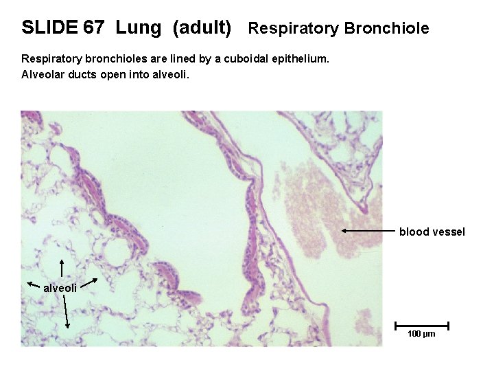 SLIDE 67 Lung (adult) Respiratory Bronchiole Respiratory bronchioles are lined by a cuboidal epithelium.
