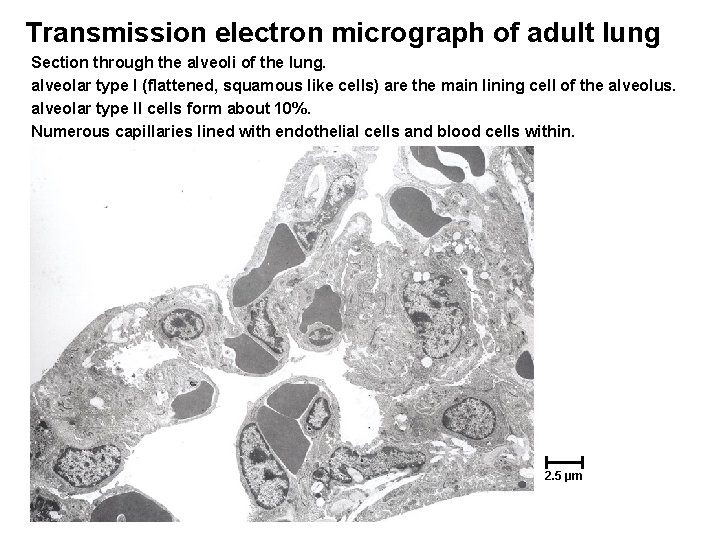 Transmission electron micrograph of adult lung Section through the alveoli of the lung. alveolar