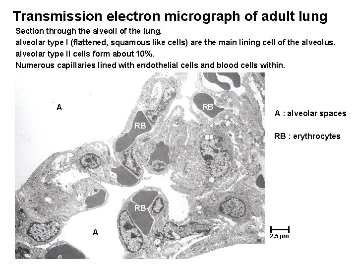 Transmission electron micrograph of adult lung Section through the alveoli of the lung. alveolar