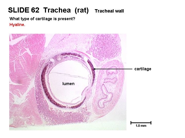 SLIDE 62 Trachea (rat) Tracheal wall What type of cartilage is present? Hyaline. cartilage