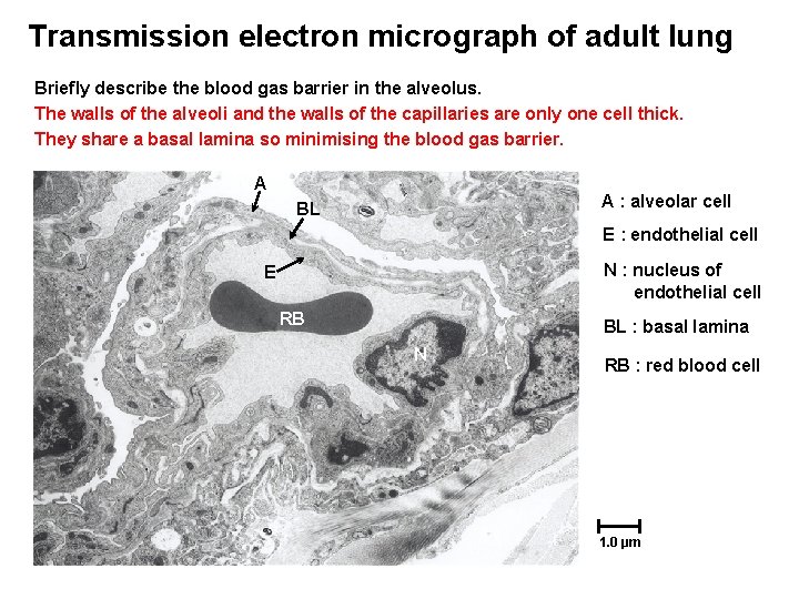Transmission electron micrograph of adult lung Briefly describe the blood gas barrier in the