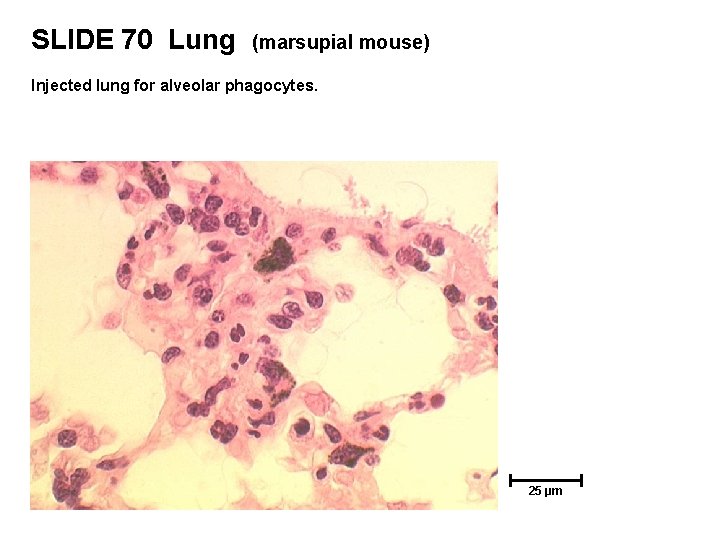 SLIDE 70 Lung (marsupial mouse) Injected lung for alveolar phagocytes. 25 µm 