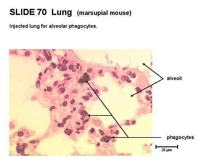 SLIDE 70 Lung (marsupial mouse) Injected lung for alveolar phagocytes. alveoli phagocytes 25 µm