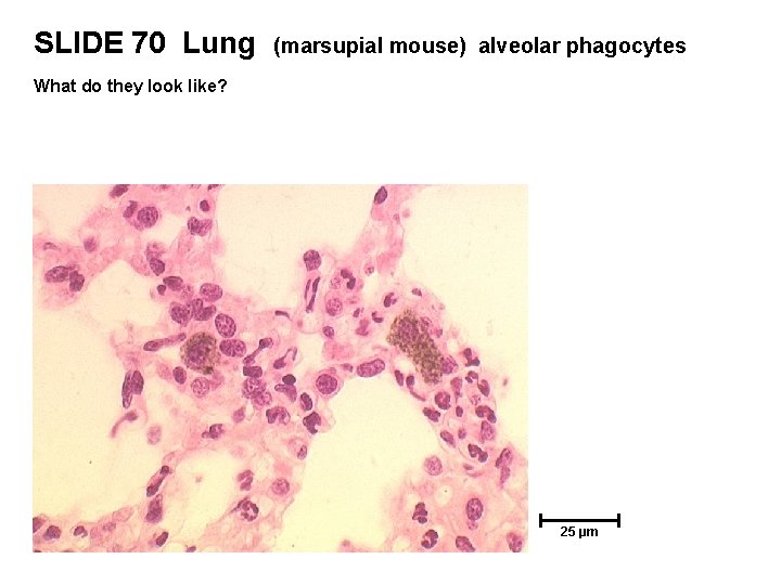 SLIDE 70 Lung (marsupial mouse) alveolar phagocytes What do they look like? 25 µm