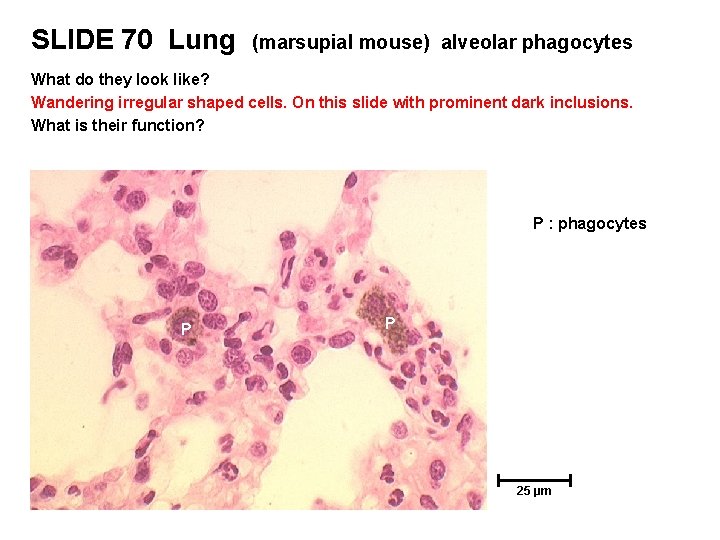 SLIDE 70 Lung (marsupial mouse) alveolar phagocytes What do they look like? Wandering irregular