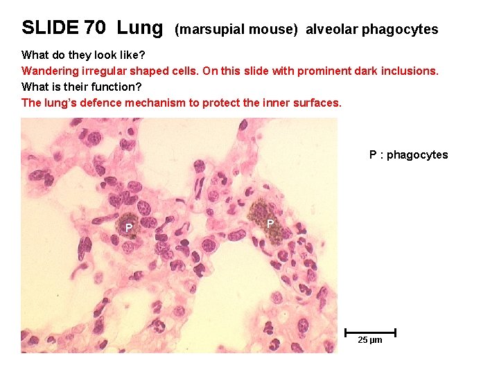 SLIDE 70 Lung (marsupial mouse) alveolar phagocytes What do they look like? Wandering irregular