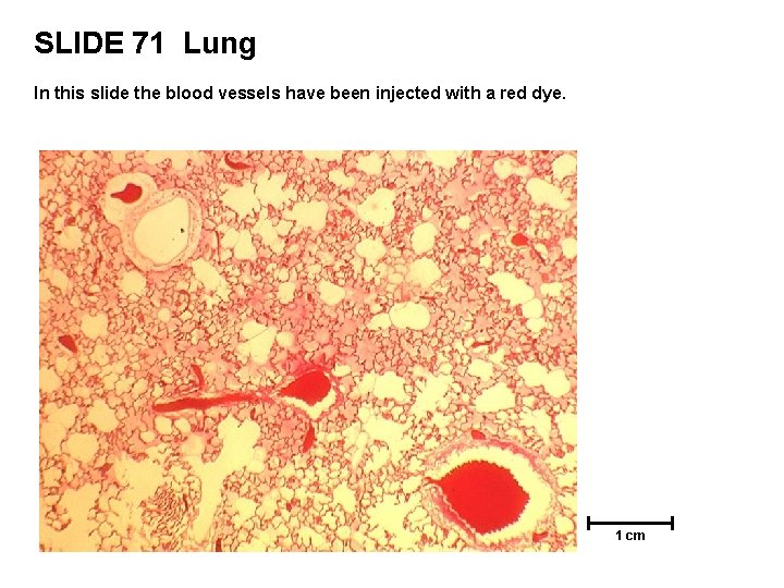SLIDE 71 Lung In this slide the blood vessels have been injected with a