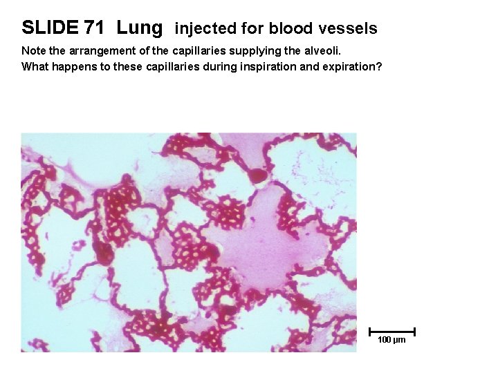 SLIDE 71 Lung injected for blood vessels Note the arrangement of the capillaries supplying