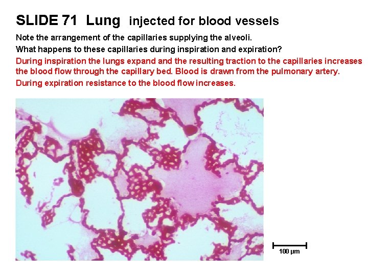 SLIDE 71 Lung injected for blood vessels Note the arrangement of the capillaries supplying