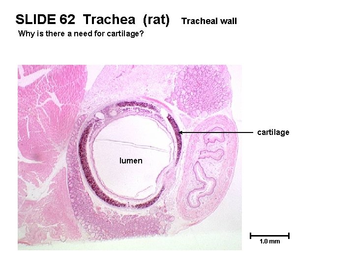 SLIDE 62 Trachea (rat) Tracheal wall Why is there a need for cartilage? cartilage