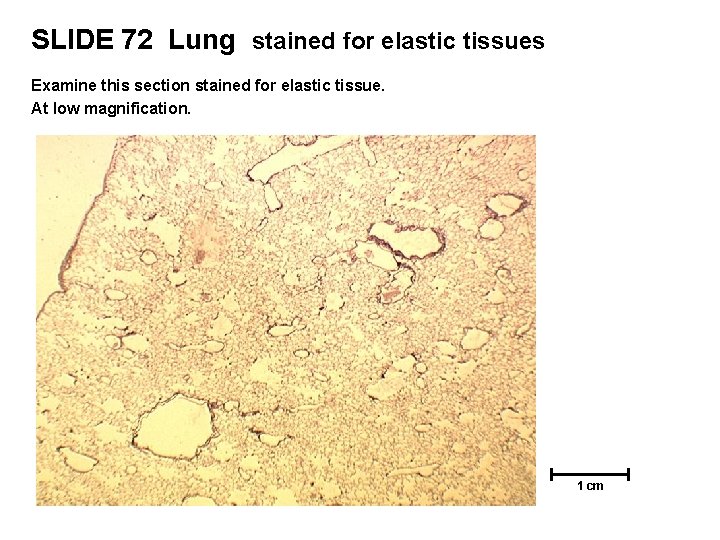 SLIDE 72 Lung stained for elastic tissues Examine this section stained for elastic tissue.