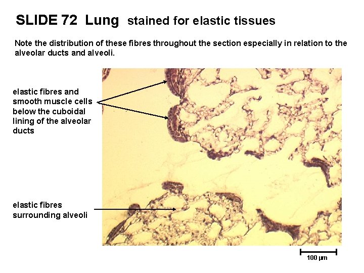 SLIDE 72 Lung stained for elastic tissues Note the distribution of these fibres throughout