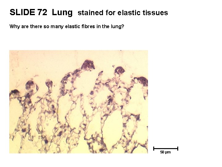 SLIDE 72 Lung stained for elastic tissues Why are there so many elastic fibres