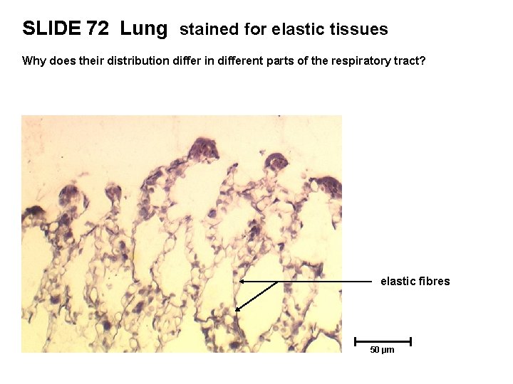 SLIDE 72 Lung stained for elastic tissues Why does their distribution differ in different