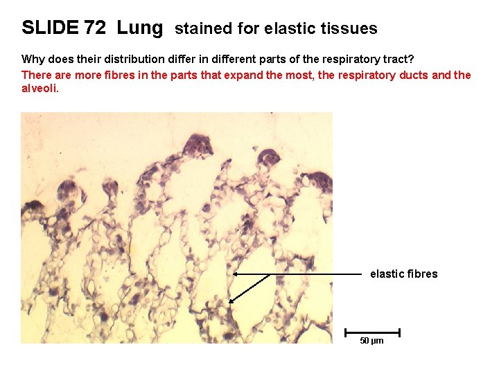 SLIDE 72 Lung stained for elastic tissues Why does their distribution differ in different