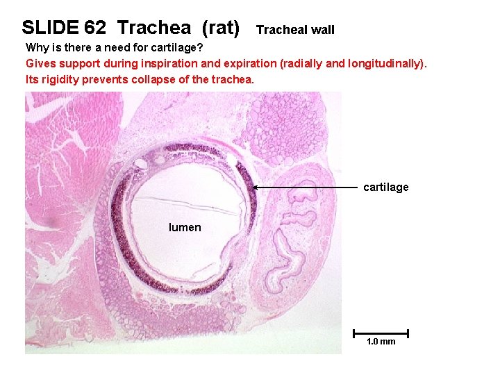 SLIDE 62 Trachea (rat) Tracheal wall Why is there a need for cartilage? Gives