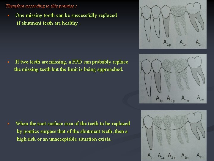 Therefore according to this premise : § § § One missing tooth can be