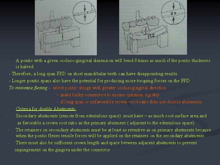 A pontic with a given occluso-gingival dimension will bend 8 times as much if