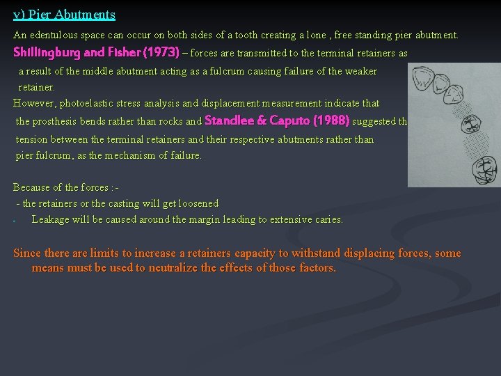 v) Pier Abutments An edentulous space can occur on both sides of a tooth