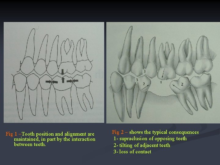 Fig 1 –Tooth position and alignment are maintained, in part by the interaction between