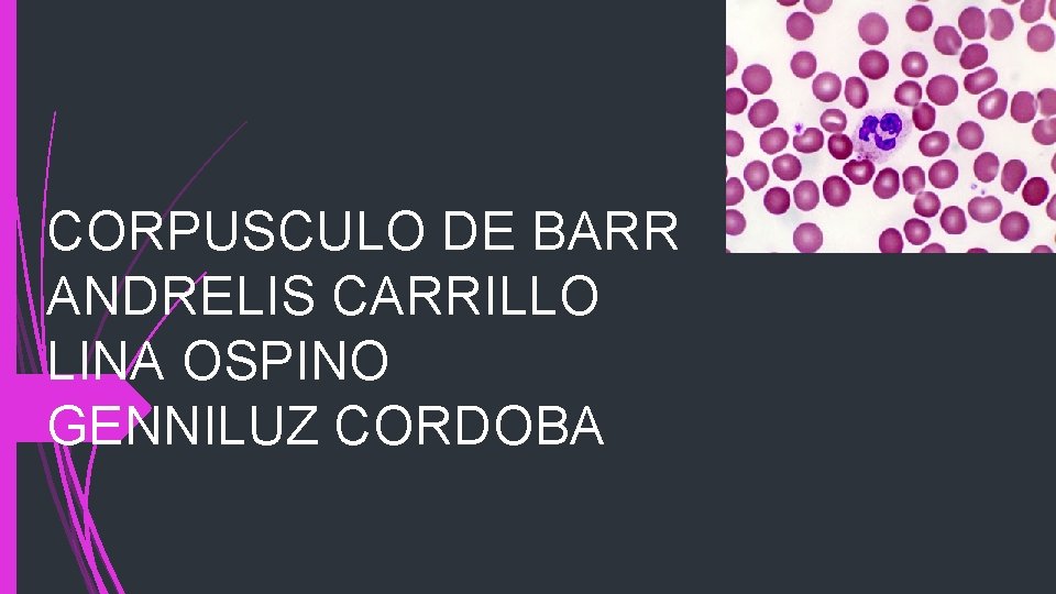 CORPUSCULO DE BARR ANDRELIS CARRILLO LINA OSPINO GENNILUZ CORDOBA 