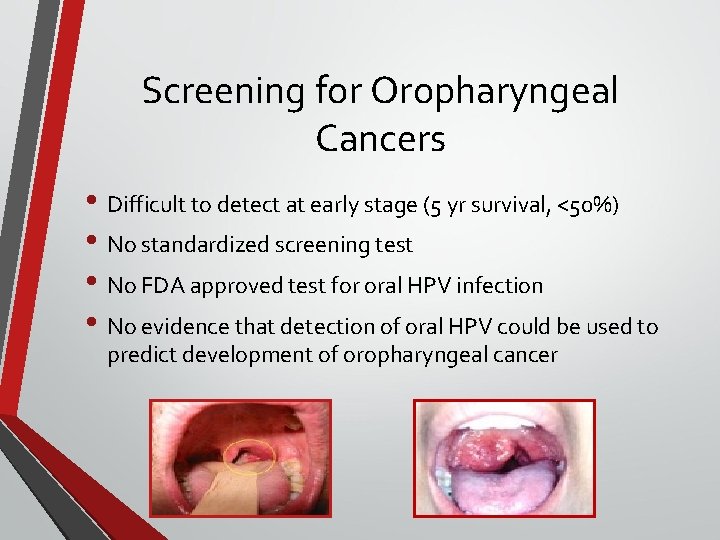 Screening for Oropharyngeal Cancers • Difficult to detect at early stage (5 yr survival,