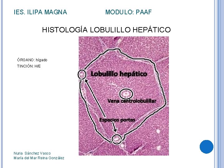 IES. ILIPA MAGNA MODULO: PAAF HISTOLOGÍA LOBULILLO HEPÁTICO ÓRGANO: hígado TINCIÓN: H/E Nuria Sánchez