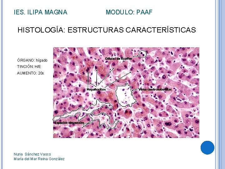 IES. ILIPA MAGNA MODULO: PAAF HISTOLOGÍA: ESTRUCTURAS CARACTERÍSTICAS ÓRGANO: hígado TINCIÓN: H/E AUMENTO: 20