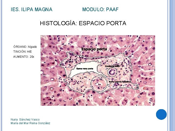 IES. ILIPA MAGNA MODULO: PAAF HISTOLOGÍA: ESPACIO PORTA ÓRGANO: hígado TINCIÓN: H/E AUMENTO: 20