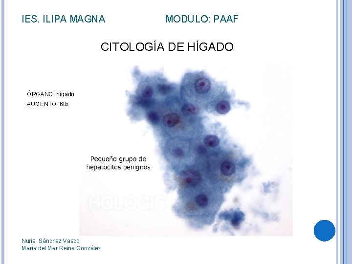 IES. ILIPA MAGNA MODULO: PAAF CITOLOGÍA DE HÍGADO ÓRGANO: hígado AUMENTO: 60 x Nuria