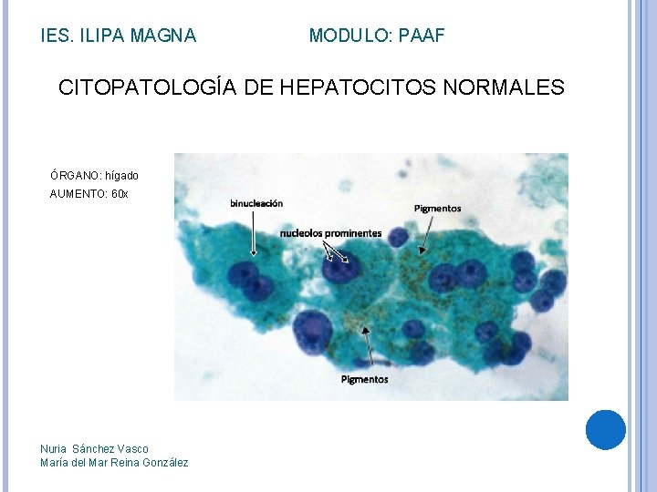 IES. ILIPA MAGNA MODULO: PAAF CITOPATOLOGÍA DE HEPATOCITOS NORMALES ÓRGANO: hígado AUMENTO: 60 x