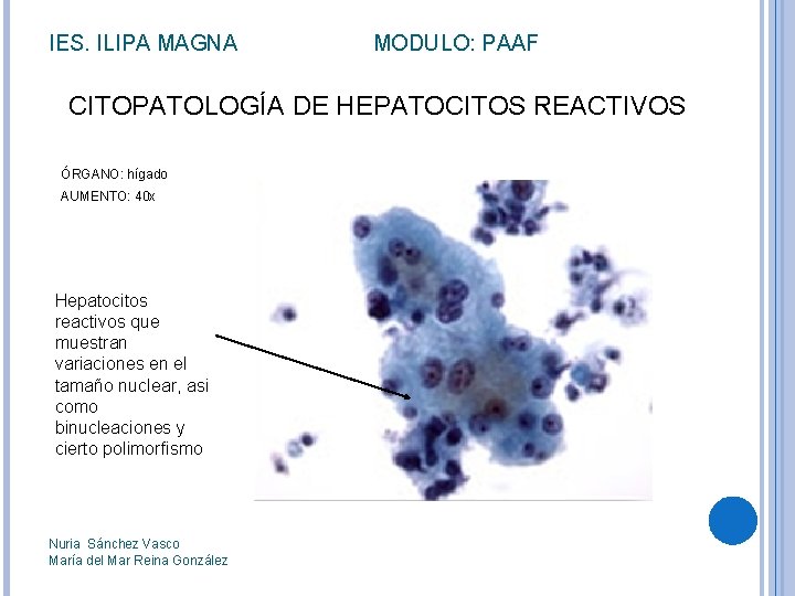 IES. ILIPA MAGNA MODULO: PAAF CITOPATOLOGÍA DE HEPATOCITOS REACTIVOS ÓRGANO: hígado AUMENTO: 40 x