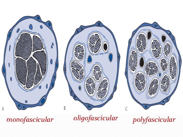 monofascicular oligofascicular polyfascicular 