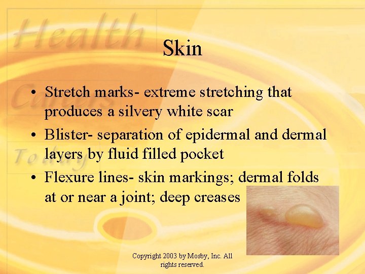 Skin • Stretch marks- extreme stretching that produces a silvery white scar • Blister-