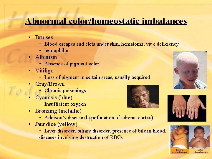 Abnormal color/homeostatic imbalances • Bruises • Blood escapes and clots under skin, hematoma, vit