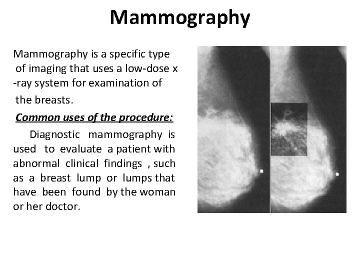 Mammography is a specific type of imaging that uses a low-dose x -ray system