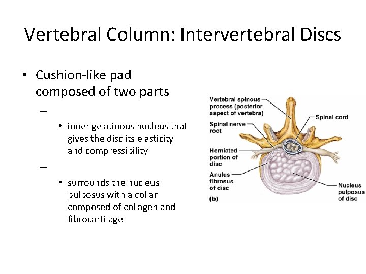 Vertebral Column: Intervertebral Discs • Cushion-like pad composed of two parts – • inner
