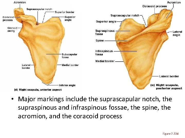  • Major markings include the suprascapular notch, the supraspinous and infraspinous fossae, the
