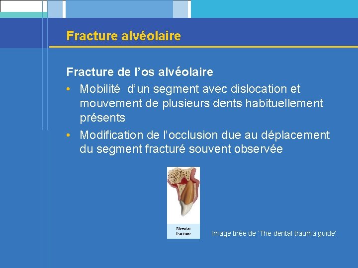 Fracture alvéolaire Fracture de l’os alvéolaire • Mobilité d’un segment avec dislocation et mouvement