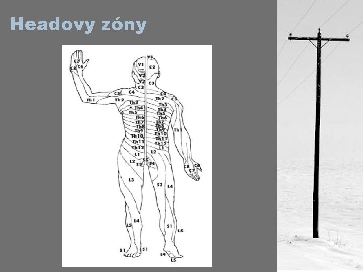 Headovy zóny 