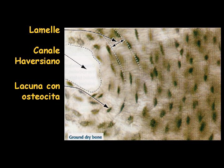 Lamelle Canale Haversiano Lacuna con osteocita Lamelle Canale Haversiano Lacuna con osteocita