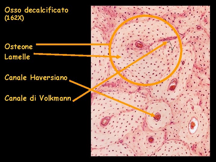 Osso decalcificato (162 X) Osteone Lamelle Canale Haversiano Canale di Volkmann Osso decalcificato (162 X) Osteone Lamelle Canale Haversiano Canale di Volkmann