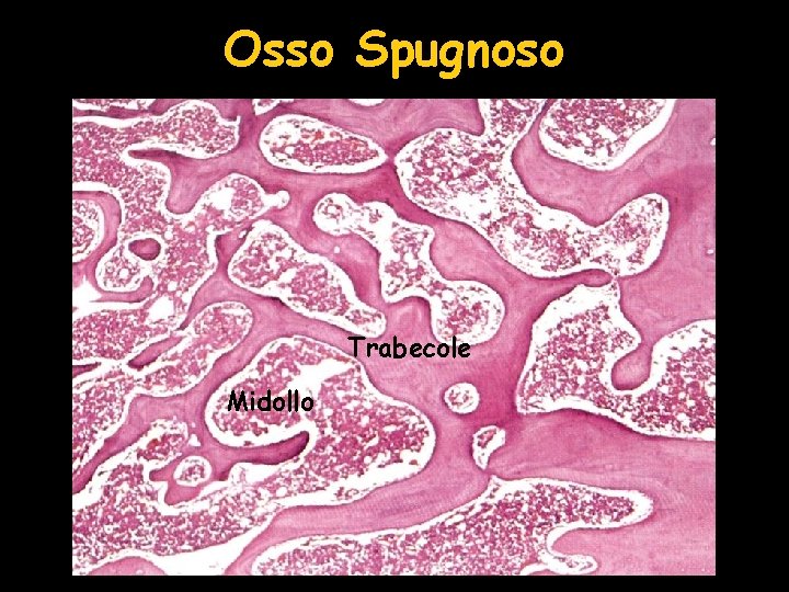 Osso Spugnoso Trabecole Midollo Osso Spugnoso Trabecole Midollo