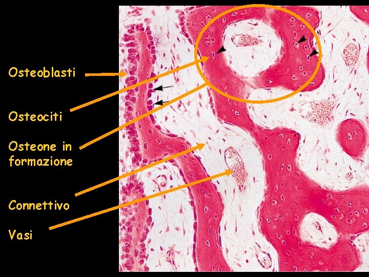 Osteoblasti Osteociti Osteone in formazione Connettivo Vasi Osteoblasti Osteociti Osteone in formazione Connettivo Vasi