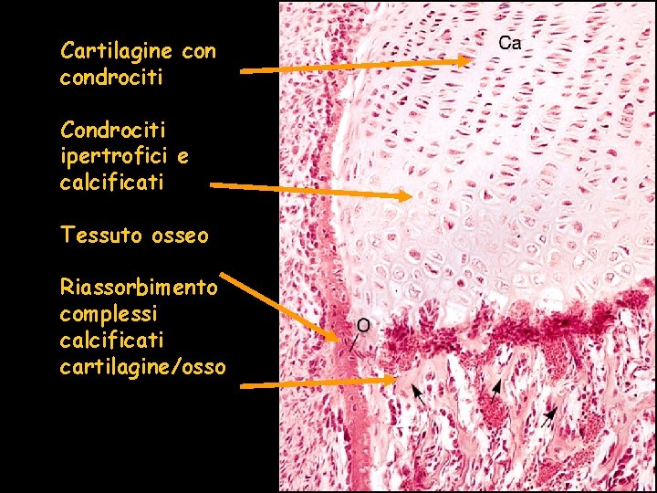 Cartilagine condrociti Condrociti ipertrofici e calcificati Tessuto osseo Riassorbimento complessi calcificati cartilagine/osso Cartilagine condrociti Condrociti ipertrofici e calcificati Tessuto osseo Riassorbimento complessi calcificati cartilagine/osso