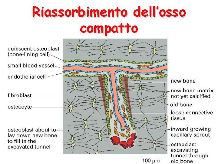 Riassorbimento dell’osso compatto Riassorbimento dell’osso compatto