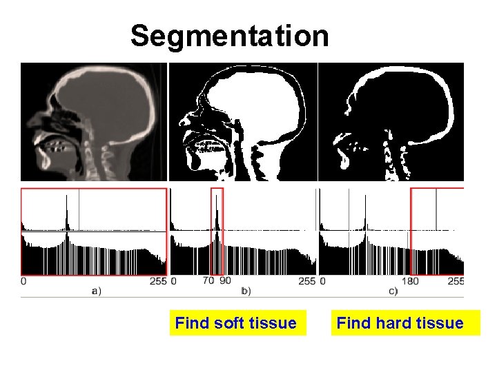 Segmentation Find soft tissue Find hard tissue 