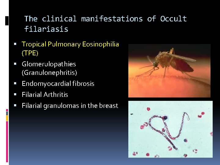 The clinical manifestations of Occult filariasis Tropical Pulmonary Eosinophilia (TPE) Glomerulopathies (Granulonephritis) Endomyocardial fibrosis