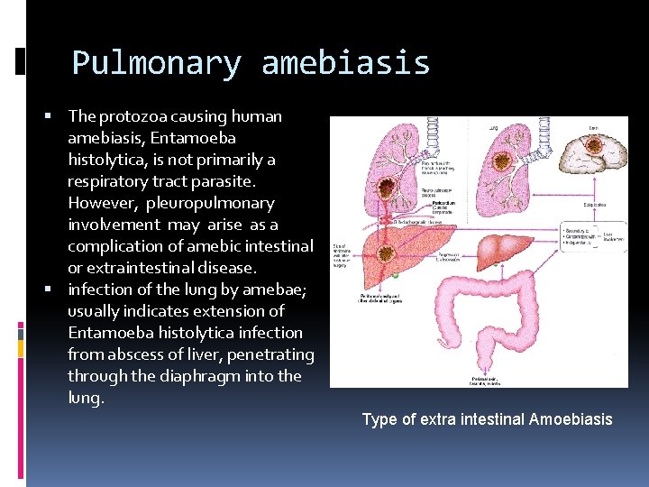 Pulmonary amebiasis The protozoa causing human amebiasis, Entamoeba histolytica, is not primarily a respiratory