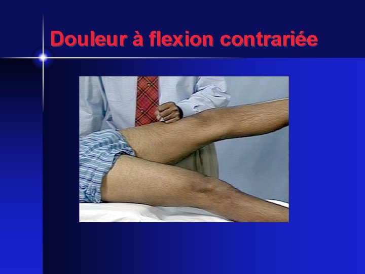 Douleur à flexion contrariée 